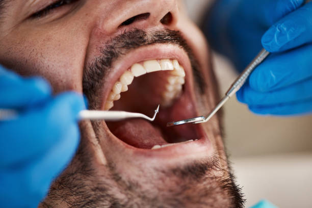Best Emergency Denture Repair in Wheeling, WV